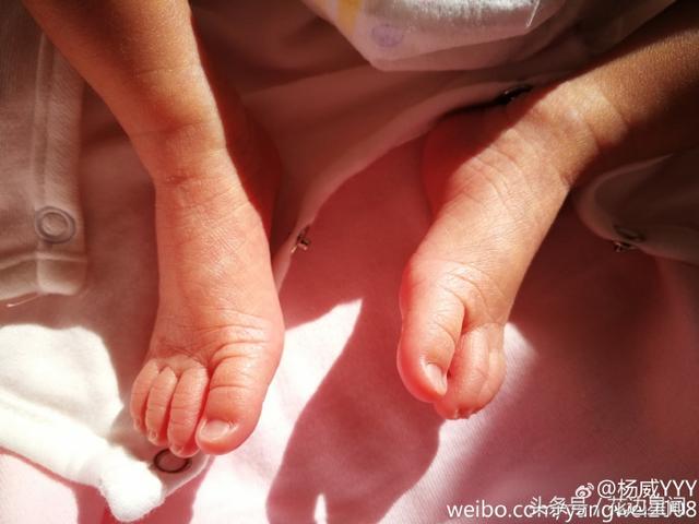 杨威晒双胞胎女儿手脚照片 羊妹妹们刚过5天就长大了
