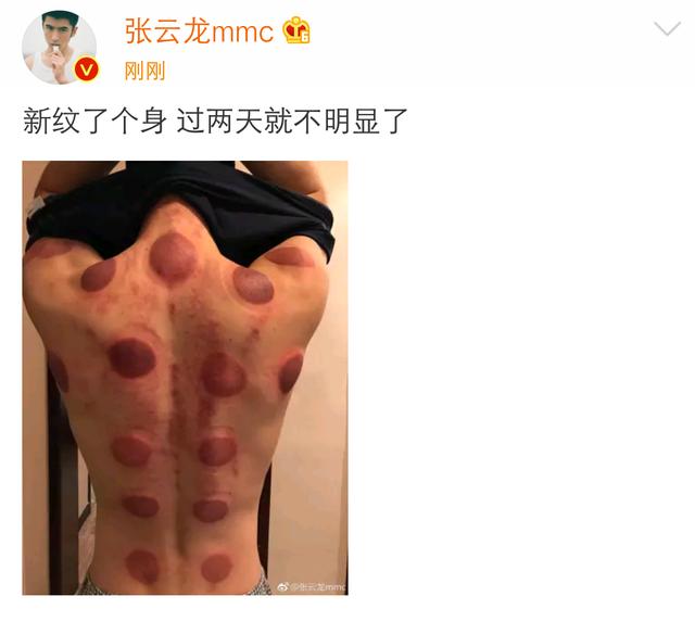 张云龙拍戏健康受损惹人心疼，网友：我们宁愿这是草莓印