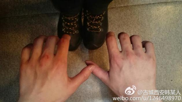 杨洋的手指甲怎么是这样的？网友：分不出男人还是女人