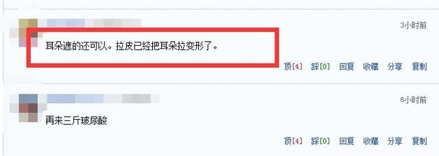 刘晓庆参加活动又年轻十岁，网友：拉皮把耳朵都拉变形了