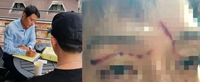 韩国女星被男友打到子宫出血，男方还坚持是女友对他施暴