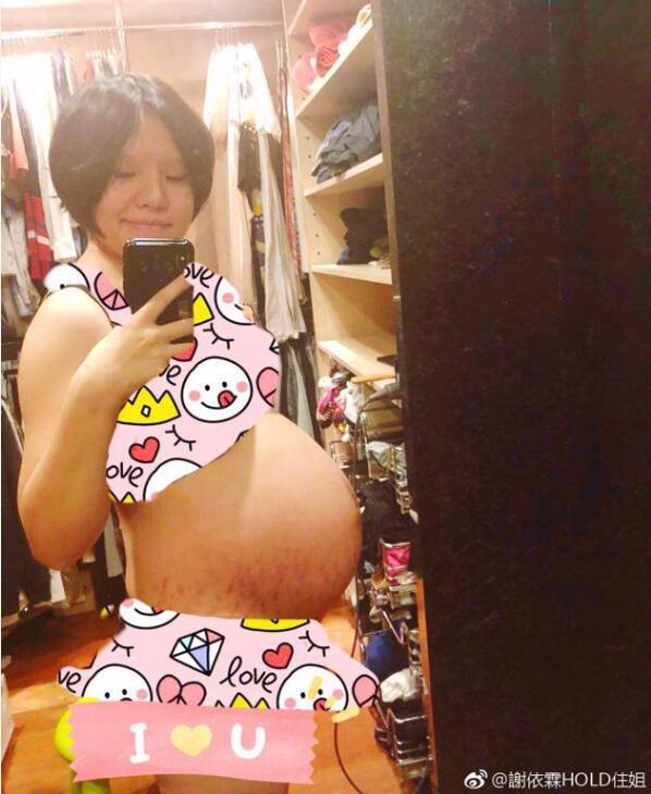 谢依霖怀孕八月巨肚长满妊娠纹，网友：娱乐圈最真实孕妇