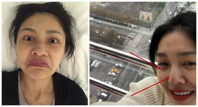 35岁佟丽娅罕见晒自拍，黑眼袋严重吓坏一众网友