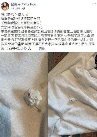 好恶心！侯佩岑控诉上海某酒店，称要穿浴袍时却发现带血卫生纸