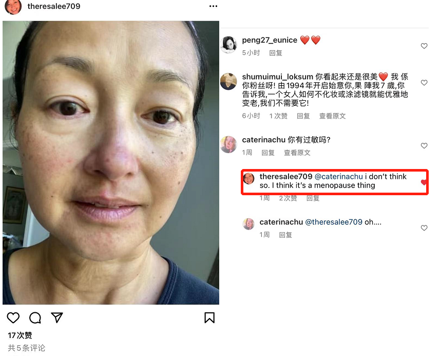 52岁李绮红自曝更年期皮肤差！鼻子下巴起红疹，脸上全部细小斑点