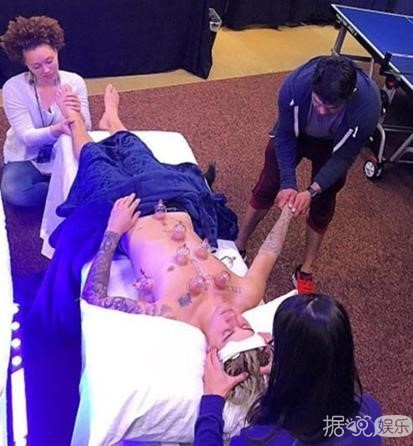 陈柏霖拔火罐留痕鲜红 网友：什么拔罐，那是我种的草莓！