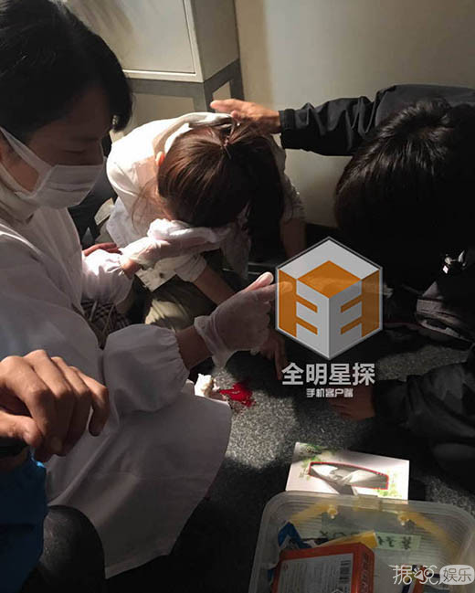 戚薇面部受伤自嘲刀疤七 这样做考虑过李承铉感受吗？