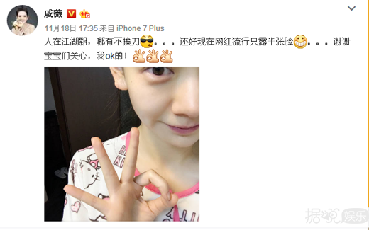 戚薇面部受伤自嘲刀疤七 这样做考虑过李承铉感受吗？