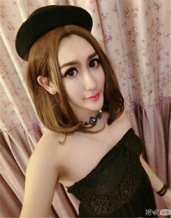 薛之谦割双眼皮留下后遗症？  长的帅还这么红为啥要整容