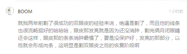 薛之谦割双眼皮留下后遗症？  长的帅还这么红为啥要整容