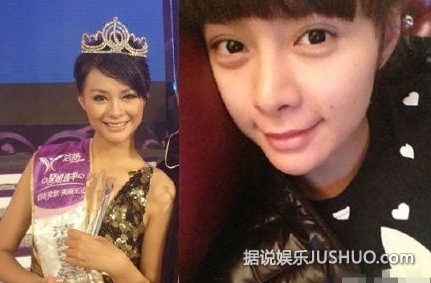 湖南台主持沈梦辰早期照曝光 整容迹象明显