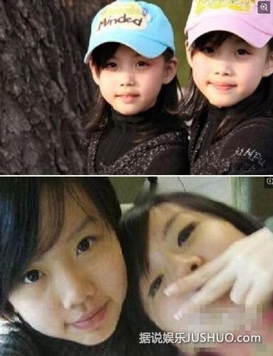 BY2不像双胞胎了!整容过度被吐槽似人妖 BY2不像双胞胎了!整容过度被吐槽似人妖