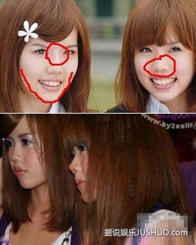 BY2不像双胞胎了!整容过度被吐槽似人妖 BY2不像双胞胎了!整容过度被吐槽似人妖