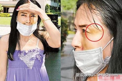 赵雅芝出轨被家暴 揭秘明星被打内幕(图) 赵雅芝出轨被家暴 揭秘明星被打内幕(图)