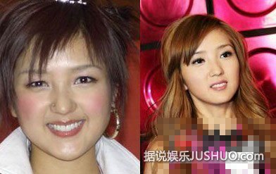 周笔畅整容前后大比对 假小子一秒变淑女 周笔畅整容前后大比对 假小子一秒变淑女