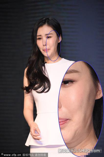 田朴珺表情僵硬嘴巴歪 疑似整容失败美脸变形