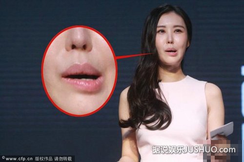 田朴珺表情僵硬嘴巴歪 疑似整容失败美脸变形