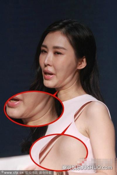 田朴珺表情僵硬嘴巴歪 疑似整容失败美脸变形