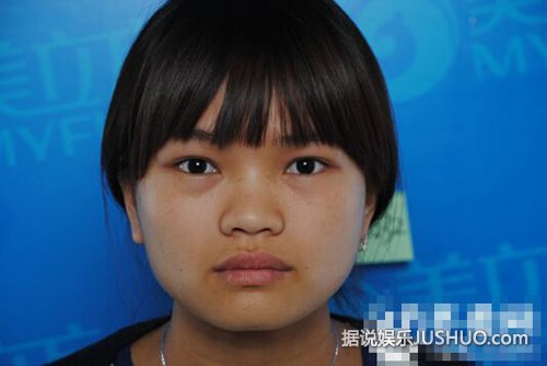 翻版 “南笙姑娘”大方承认整容 自曝旧照前后变化大