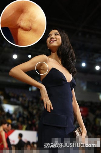 张梓琳腋下似有缝合疤痕疑隆胸 开扒娱乐圈被疑隆胸的女星