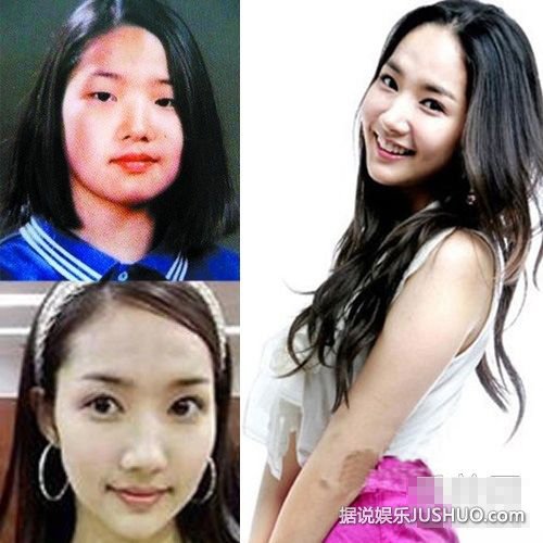 陈学冬李多海杨幂范爷 16位明星整容前后对比 陈学冬李多海杨幂范爷 16位明星整容前后对比