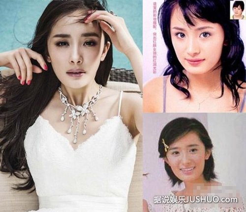 陈学冬李多海杨幂范爷 16位明星整容前后对比 陈学冬李多海杨幂范爷 16位明星整容前后对比