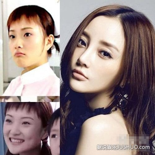 陈学冬李多海杨幂范爷 16位明星整容前后对比 陈学冬李多海杨幂范爷 16位明星整容前后对比
