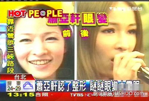 陈学冬李多海杨幂范爷 16位明星整容前后对比 陈学冬李多海杨幂范爷 16位明星整容前后对比