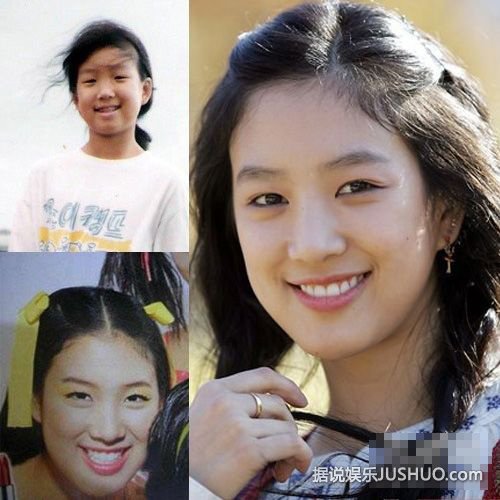 陈学冬李多海杨幂范爷 16位明星整容前后对比 陈学冬李多海杨幂范爷 16位明星整容前后对比