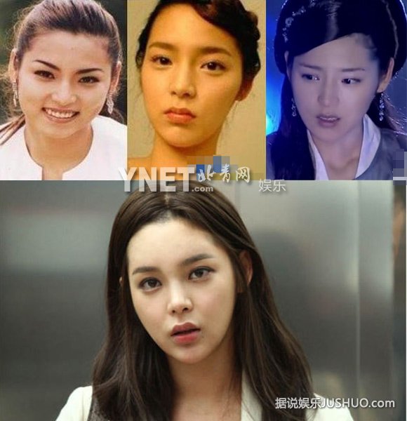 全智贤尹恩惠韩彩英 图揭韩国娱乐圈整容内幕