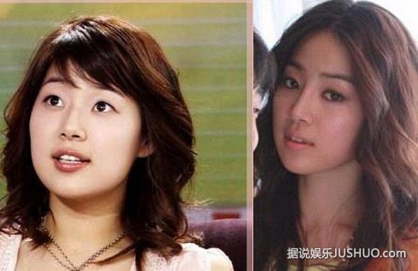 全智贤尹恩惠韩彩英 图揭韩国娱乐圈整容内幕