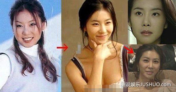 全智贤尹恩惠韩彩英 图揭韩国娱乐圈整容内幕