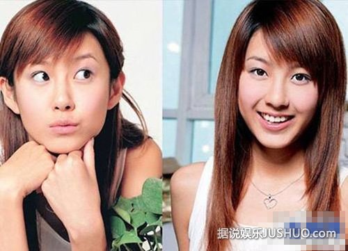 陈赫小三张子萱整容前旧照被挖 被指太丑吓哭网友