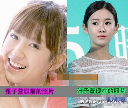 陈赫小三张子萱整容前旧照被挖 被指太丑吓哭网友