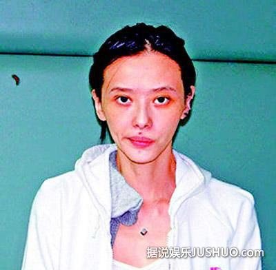 柯震东复出 盘点明星吸毒前后对比照 柯震东复出 盘点明星吸毒前后对比照