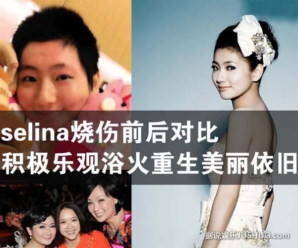 Selina忆烧伤飙泪,关心俞灏明！