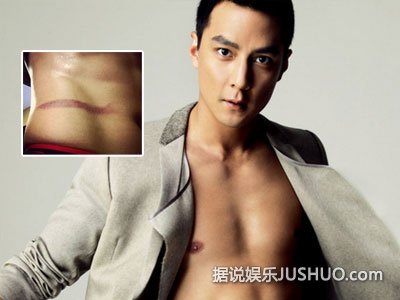 吴彦祖晒受伤照 性感腹肌抢镜遭调侃