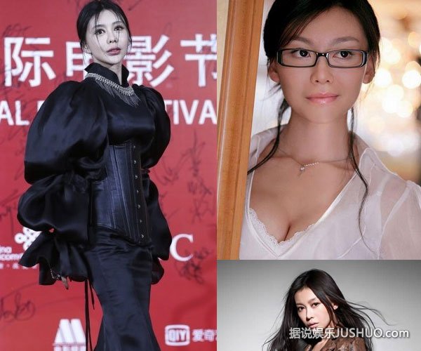 巩新亮整容失败变大小眼 揭明星整容前后