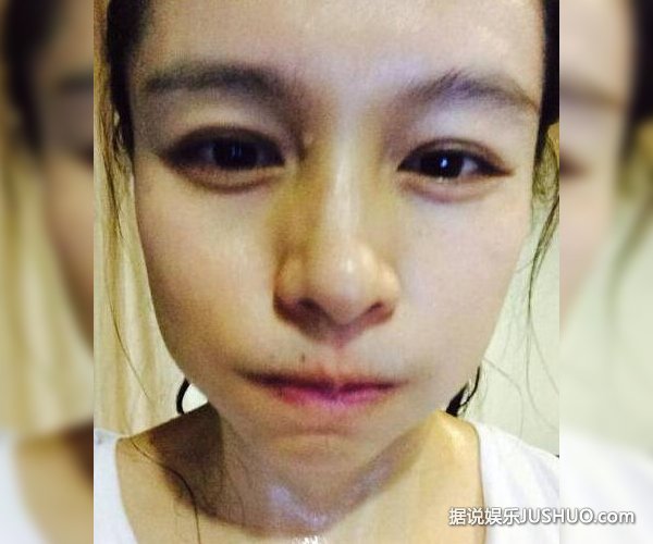 徐若瑄婚后的“主妇生活” 打扫卫生受伤