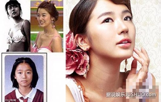 韩国女星整容变脸对比照 韩国女星整容变脸对比照