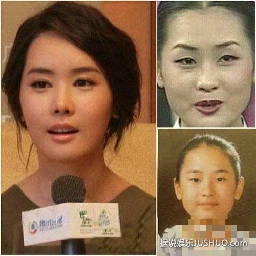 韩国女星整容变脸对比照 韩国女星整容变脸对比照