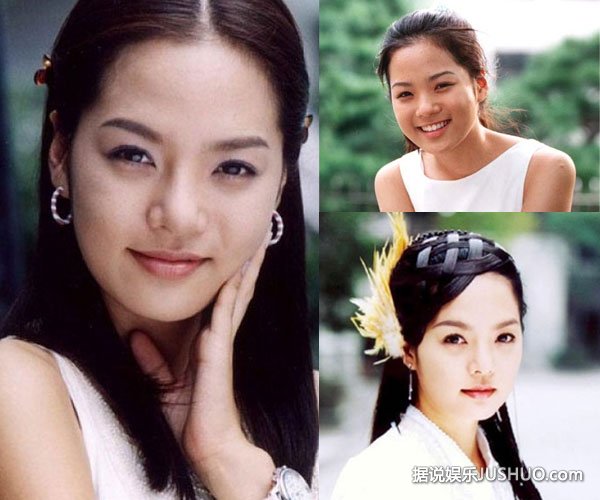 蔡琳整容失败 变脸速度超出常人