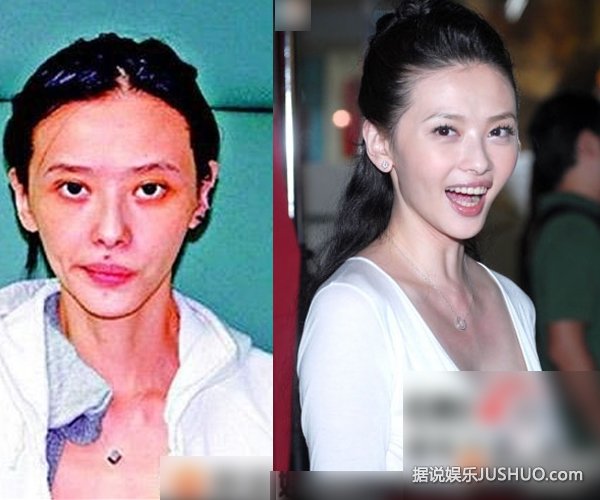 安吉丽娜朱莉昔日吸毒照曝光 全身针孔黑眼圈惊