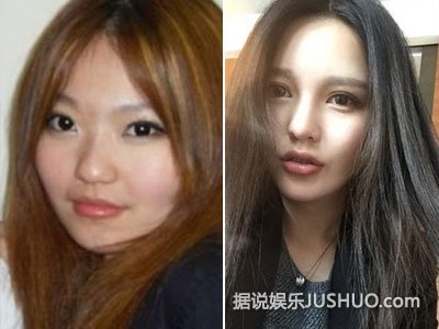 小猪绯闻女友敢做敢当 承认整容