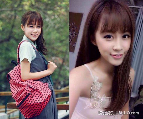 邹杨拍新戏牺牲大 浑身缠数圈纱布