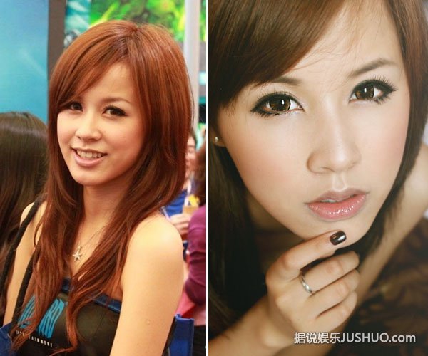 邹杨拍新戏牺牲大 浑身缠数圈纱布