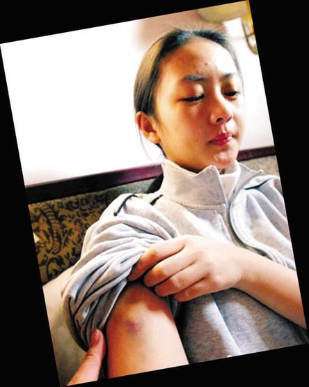 张默的女友 张默为什么殴打童瑶 张默暴打女友童瑶原因真相 张默的女友 张默为什么殴打童瑶 张默暴打女友童瑶原因真相