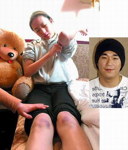 张默的女友 张默为什么殴打童瑶 张默暴打女友童瑶原因真相 张默的女友 张默为什么殴打童瑶 张默暴打女友童瑶原因真相