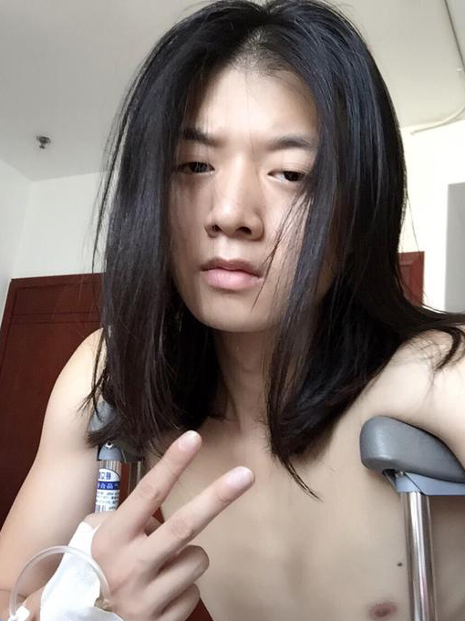 霍尊膝盖手术顺利结束 术后脸色显憔悴拄双拐不忘摆剪刀手拍照 霍尊膝盖手术顺利结束 术后脸色显憔悴拄双拐不忘摆剪刀手拍照