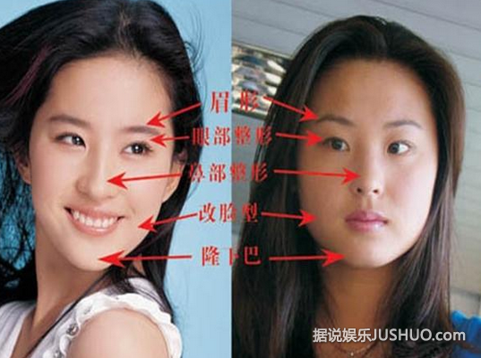刘亦菲被曝整容？天生丽质也要靠整容？